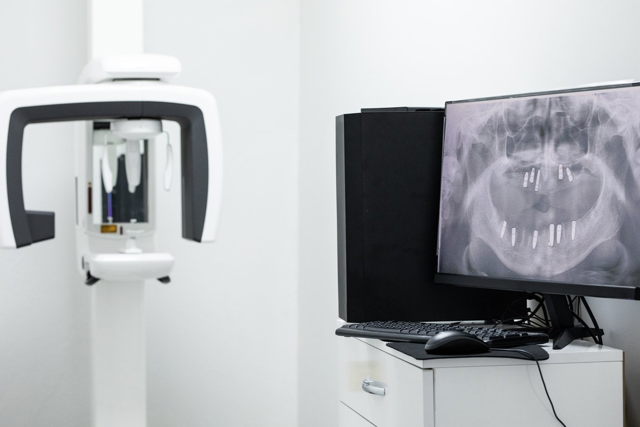 Dentist Pendleton IN